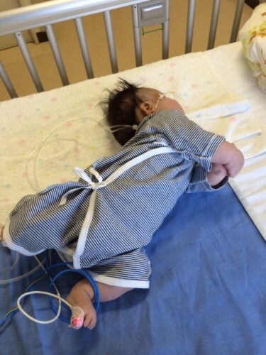【ダウン症児】寝返り練習